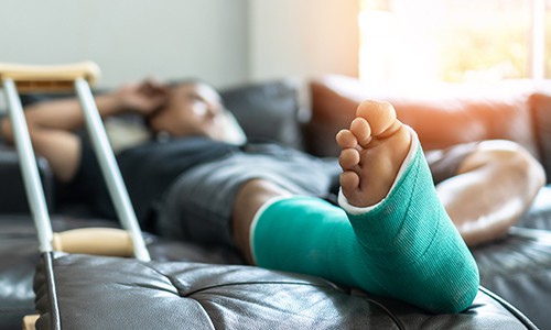Man Laying On a Bed with a Green Cast